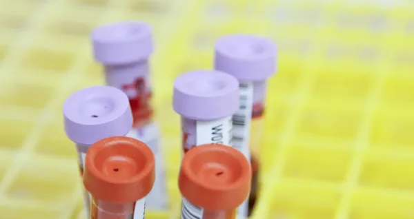 Cancer Psad 1