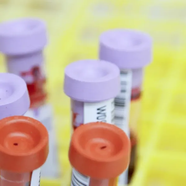 Cancer Psad 1